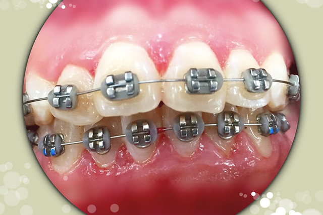 4：矯正歯科